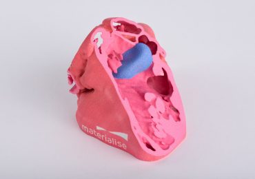 一个心脏解剖3 d打印模型实现和惠普。通过实现照片。