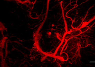 血管浸润的3 d打印的结构。通过隆德大学形象。