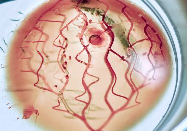 3 d打印的软组织支架。照片通过3 d系统。