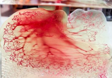 使用3D系统的打印灌注过程创建的人体血管系统模型。图片来自联合治疗公司。