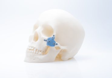 HA480 3D打印的颧骨植入物。图片来自Lithoz。