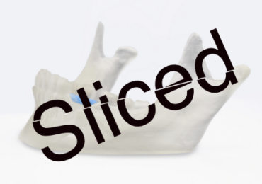 生物可吸收的颚骨。图片来自Lithoz。