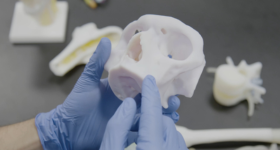 解剖学上的3 d打印模型允许医务人员实践和手术的计划。通过Stratasys公司形象。