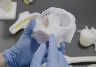 Anatomic 3D-printed models allow medical staff to practice and plan for surgeries. Image via Stratasys.