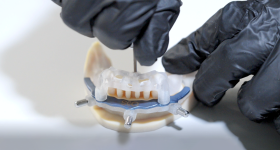 3 d印制牙科组件。通过Stratasys公司照片。