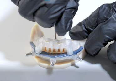 3 d印制牙科组件。通过Stratasys公司照片。